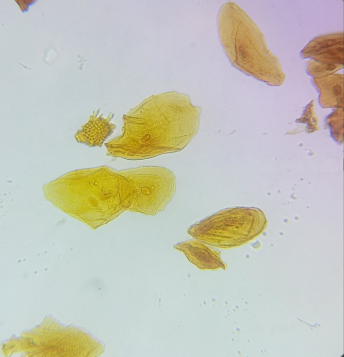 <p>What stain was used in this sample?</p>