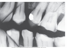 <p>What is the problem with this Creasing X-ray?</p>