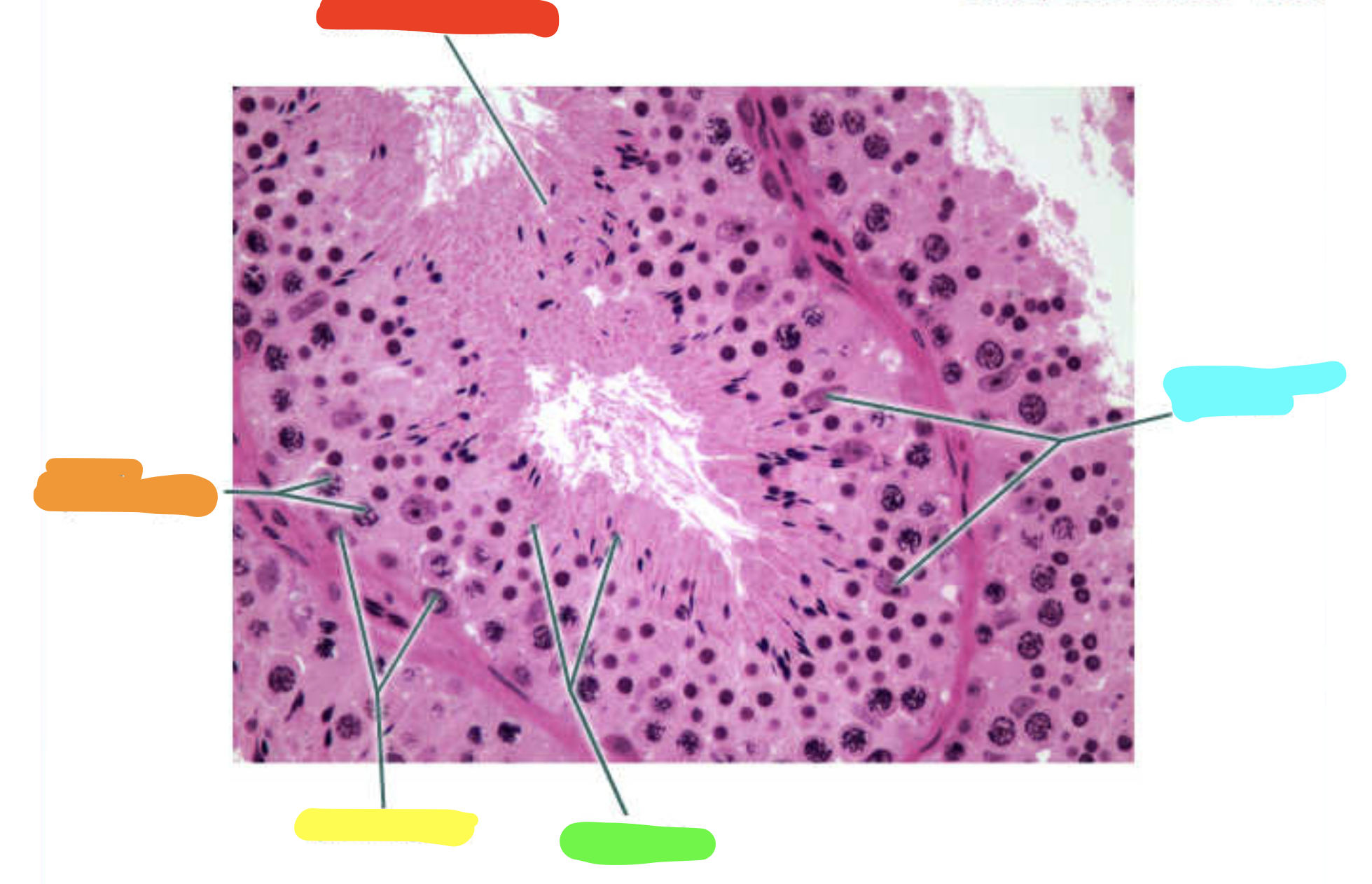 <p>What is this a slide of?</p>