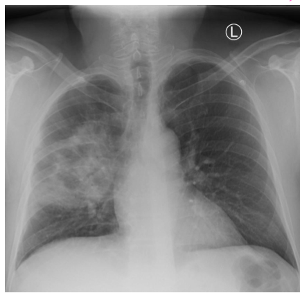 <p>whats the dx </p>