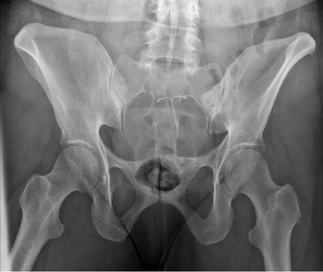 <p>what view is this? tube angle</p>