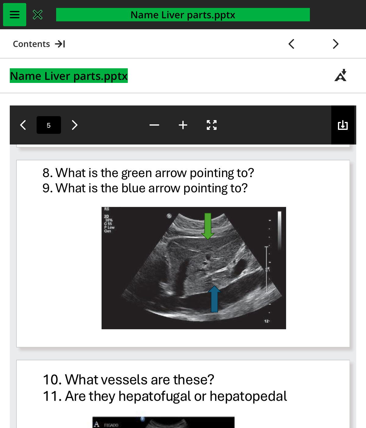 <ol start="9"><li><p>what is the blue arrow pointing to</p></li></ol>
