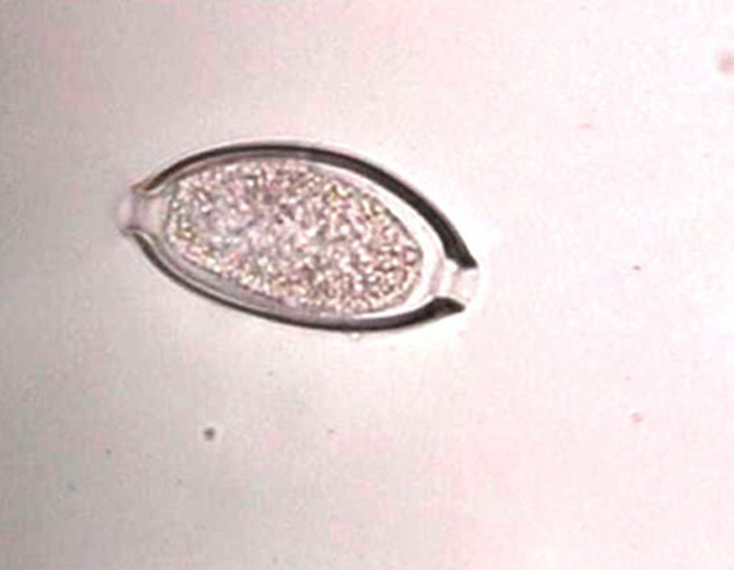 <p>bladder worm</p>