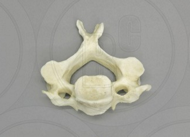 <p>Which Vertebrae is this? </p>
