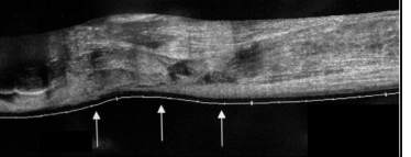 <p>Echografie</p>