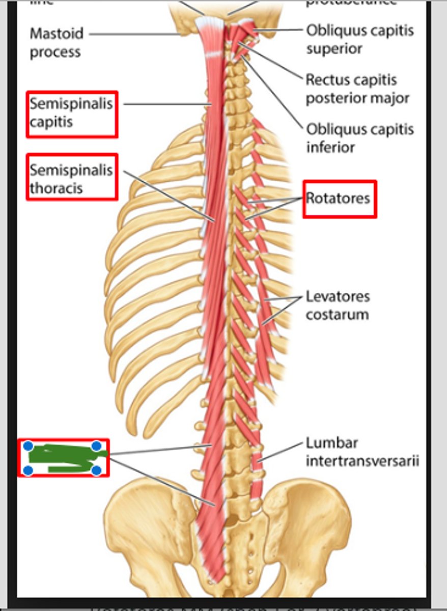 <p>Found in the lumbar, thoracic, and cervical regions</p>
