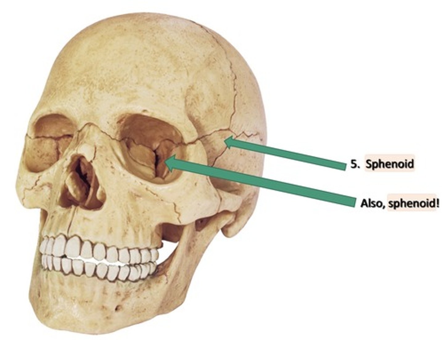 <p>1. On the lateral aspect of the skull</p><p>2. Inferior to the frontal bone</p><p>3. Anterior to the temporal bone</p><p>4. Posterior to the maxillary bone</p><p>5. Superior to the mandible</p><p>6. Lateral to the ethmoid</p><p>7. Has 4 parts:</p><p>8. Lesser wing</p><p>9. Greater wing</p><p>10. Pterygoid process (allows for jaw movement)</p><p>11. Body of this bone</p><p>12. Solitary</p><p>13. In the middle cranial fossa</p><p>14. Contains a sinus</p><p>15. In the lateral wall of the orbit</p>