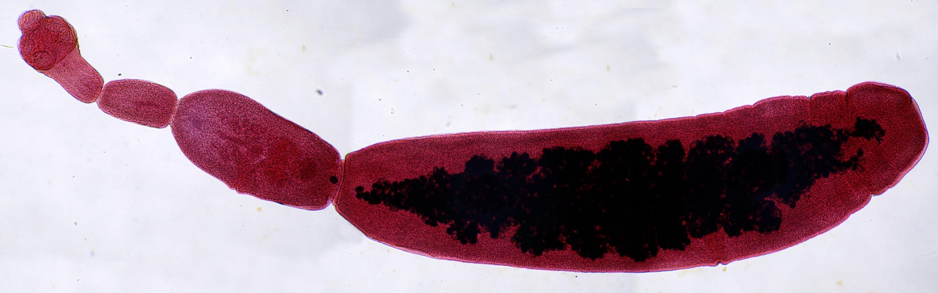 <p>Echinococcus granulosus adult</p><p>Looks like a c*ck</p>
