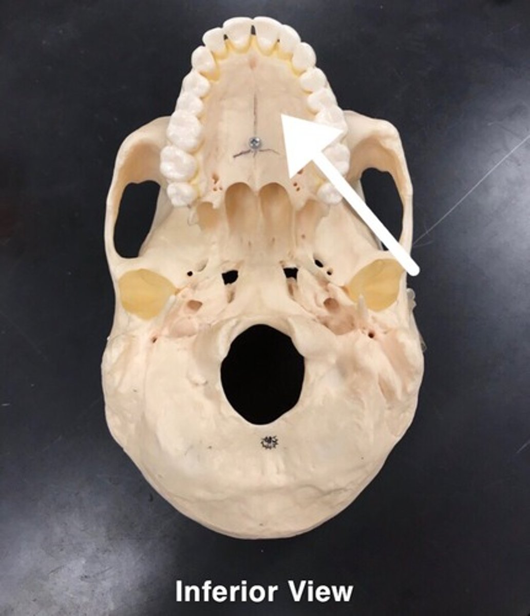 <p>What is this?</p>