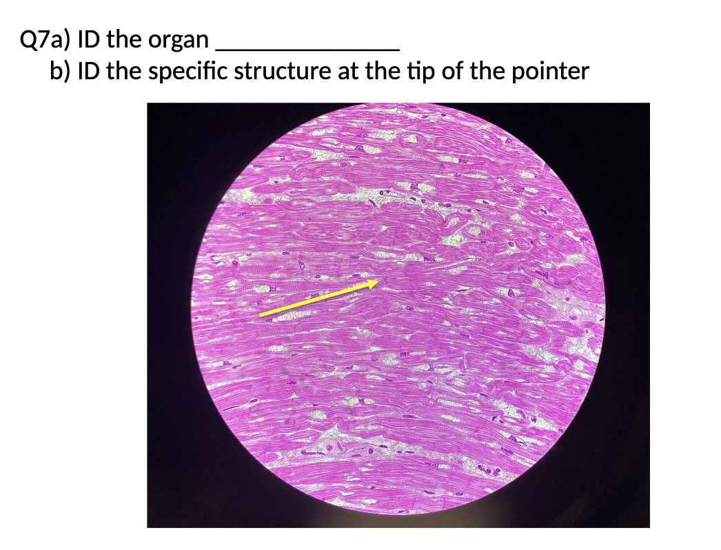 <p>Identify the organ&nbsp;<br>Identify the specific structure at the tip of the pointer</p>