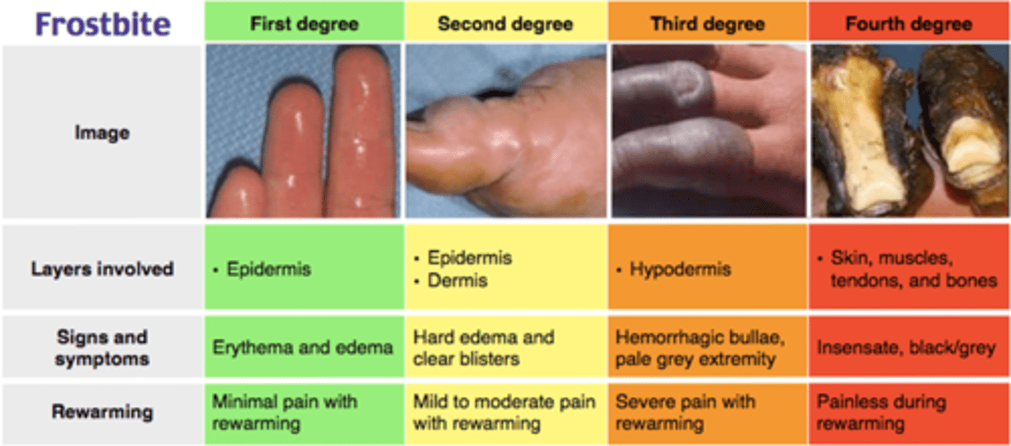 <p>1. First Degree: Superficial involvement with erythema and edema (full function remains, get warmth (eg. water) to the affected area asap!)</p><p>2. Second Degree: Formation of clear blisters; the skin remains soft (still functional/pliable)</p><p>3. Third Degree: Hemorrhagic blisters indicating deeper injury (filled with blood, SOME fx remains)</p><p>4. Fourth Degree: Full-thickness damage affecting muscles, tendons, and bones (cannot move affected joint, DEEP injury, may not be saveable)</p>