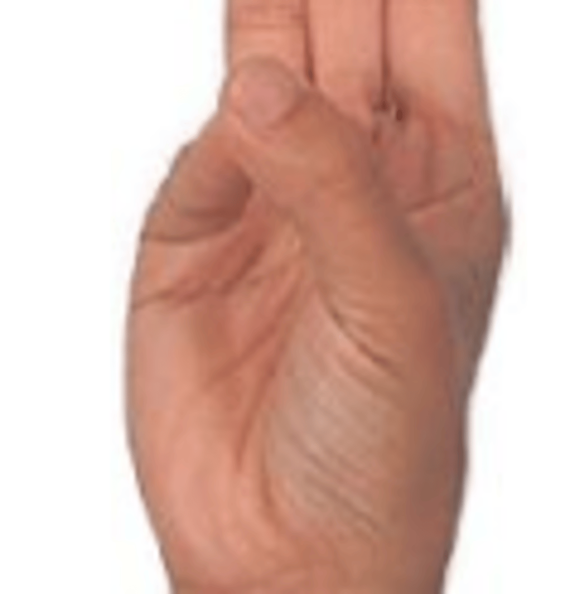 <p>tai vienos kūno dalies priešpastatymas kitoms</p>