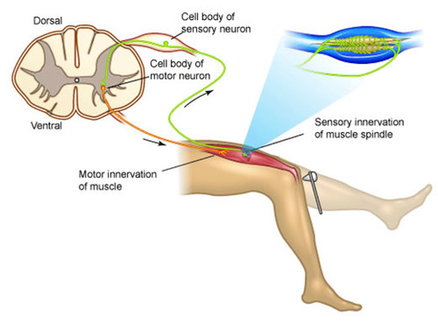 <p>Type of reflex that involves skeletal muscle</p>