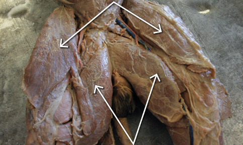 <p>anterior view, top arrows</p>