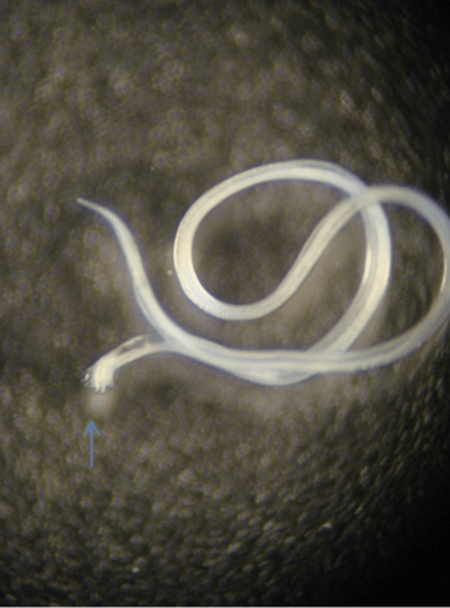 <p>What is this parasite? What characteristic/s did you use to identify it?</p>