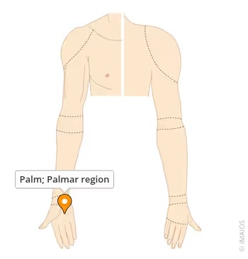 <p>palm</p>