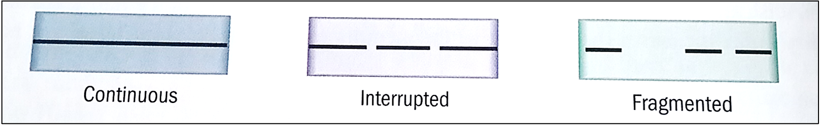 <p>continuous, interrupted, fragmented</p>