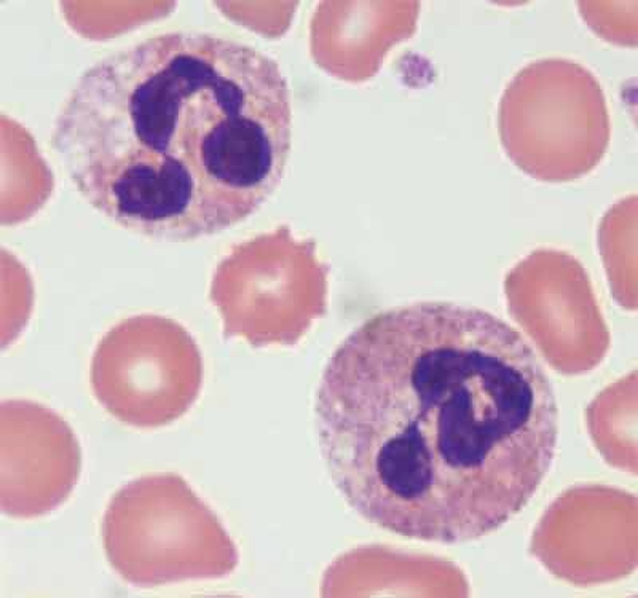<p>- large blood cell</p><p>- has a multi-lobe nucleus (still one nucleus but has multiple lobes)</p><p>- contains neutrophilic granules in the cytoplasm (does not pick up color when looking through a microcope)</p><p>- ONLY cell to have a "drum stick"</p><p>----------------------------------</p><p>engulfs foreign and damaged cells (phagocytosis); most numerous of the leukocytes</p>