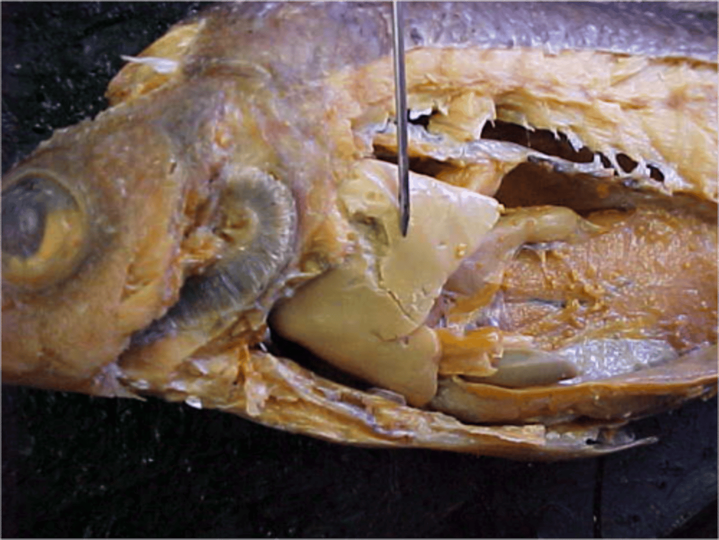 <p>Large structure that detoxifies poisons, produces bile, and helps digest fat among other functions.</p>