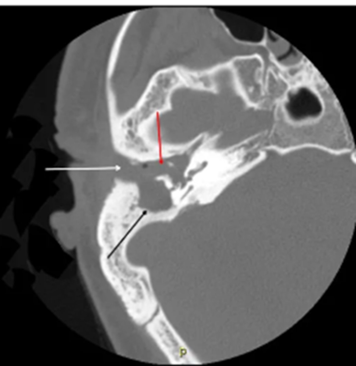 <p>typically performed to assess the extent of disease and any associated complications prior to surgical treatment</p>