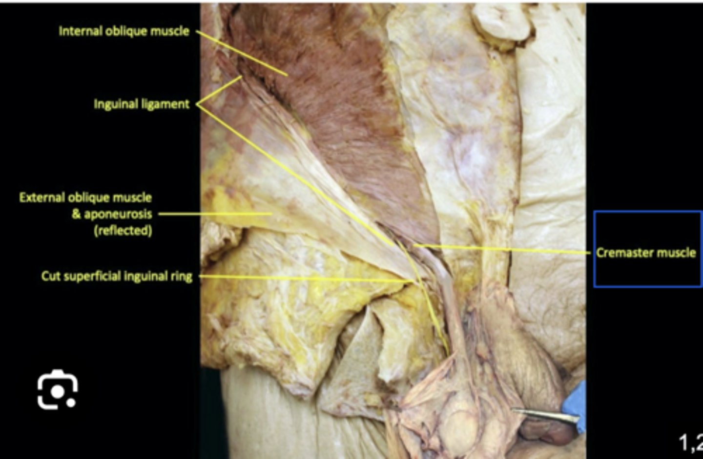 knowt flashcard image