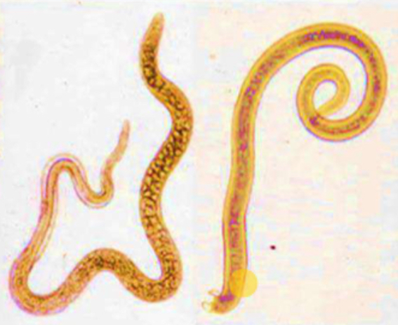 <p>Parasite under microscope</p>