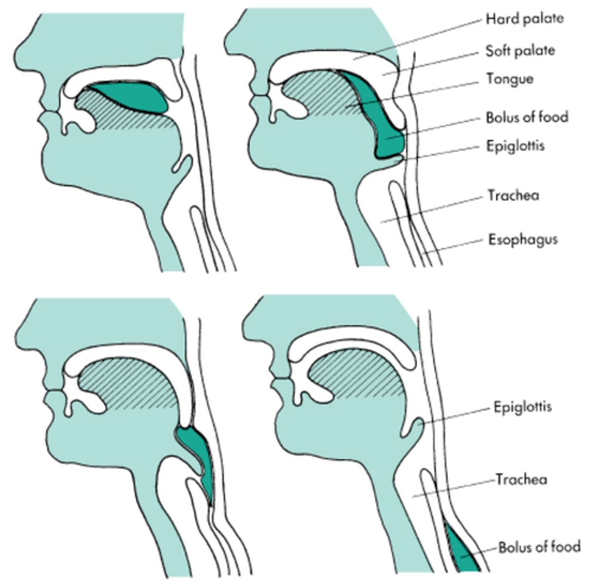 <p>Oral Preparatory</p><p>OralTransport</p><p>Pharyngeal Transport</p><p>Esophageal Transport</p><p>OP &amp; OT are voluntary; PT &amp; ET are reflexive</p><p>These phases can sometimes overlap</p>