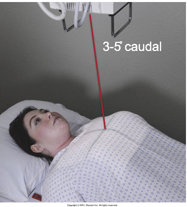 <ul><li><p>IR behind pt, align center of IR to CR (top of IR about 1.5 inches above shoulders</p></li><li><p>Center pt to CR & IR</p></li><li><p>Roll pt’s shoulder’s forward if condition allows</p></li></ul><p></p>