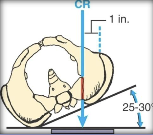 <p>posterior oblique SI joints body rotation</p>