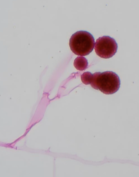 <p>Mucor circinelloides</p>