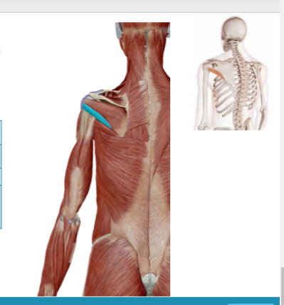 <p>Welke spier is dit</p>