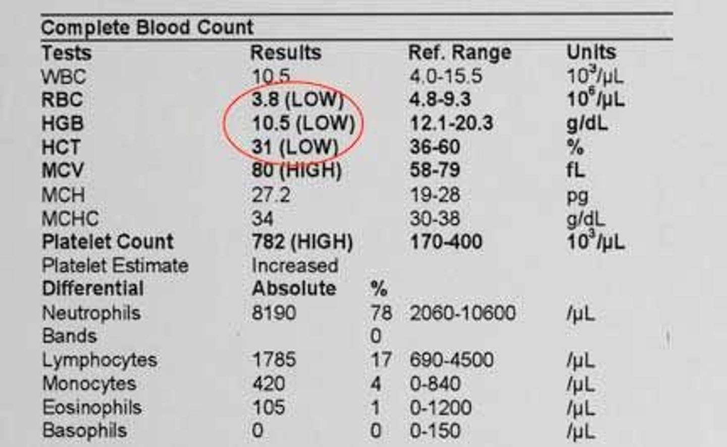 <p>Anemia or inadequate volume of blood to anticoagulant ratio.</p>