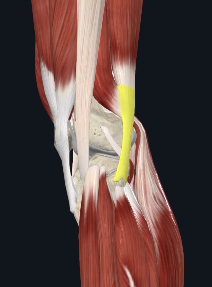 <p>biceps femoris tendon</p>