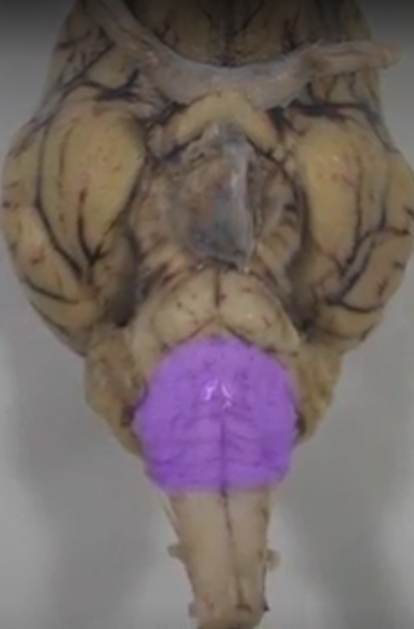 what part of the brain is this?