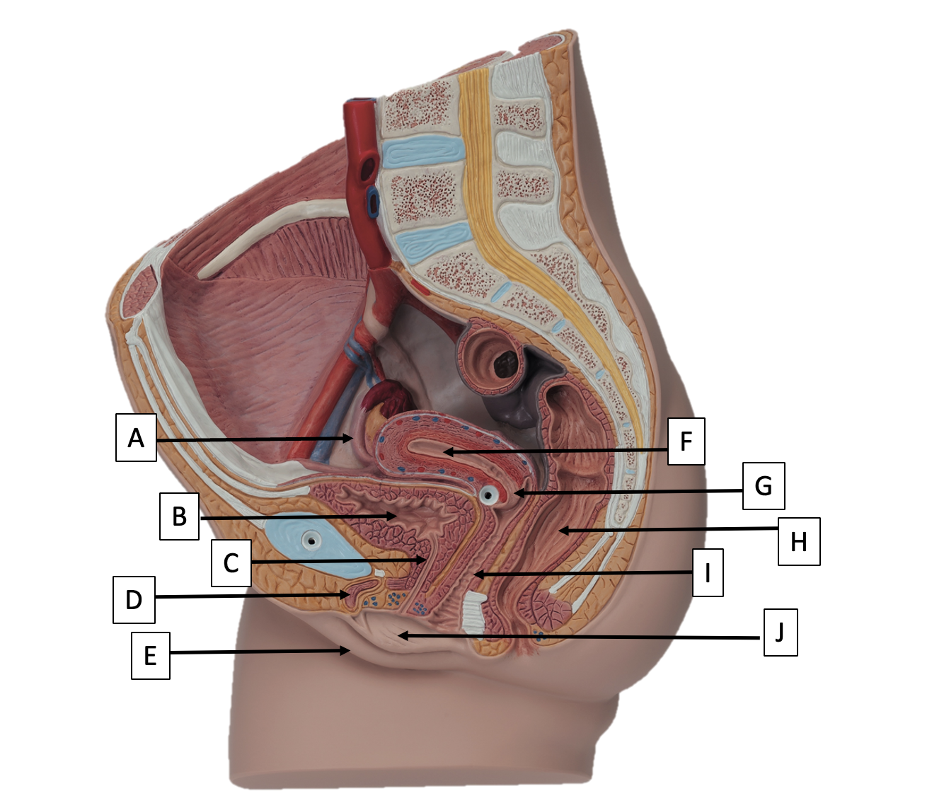 <p>A</p>