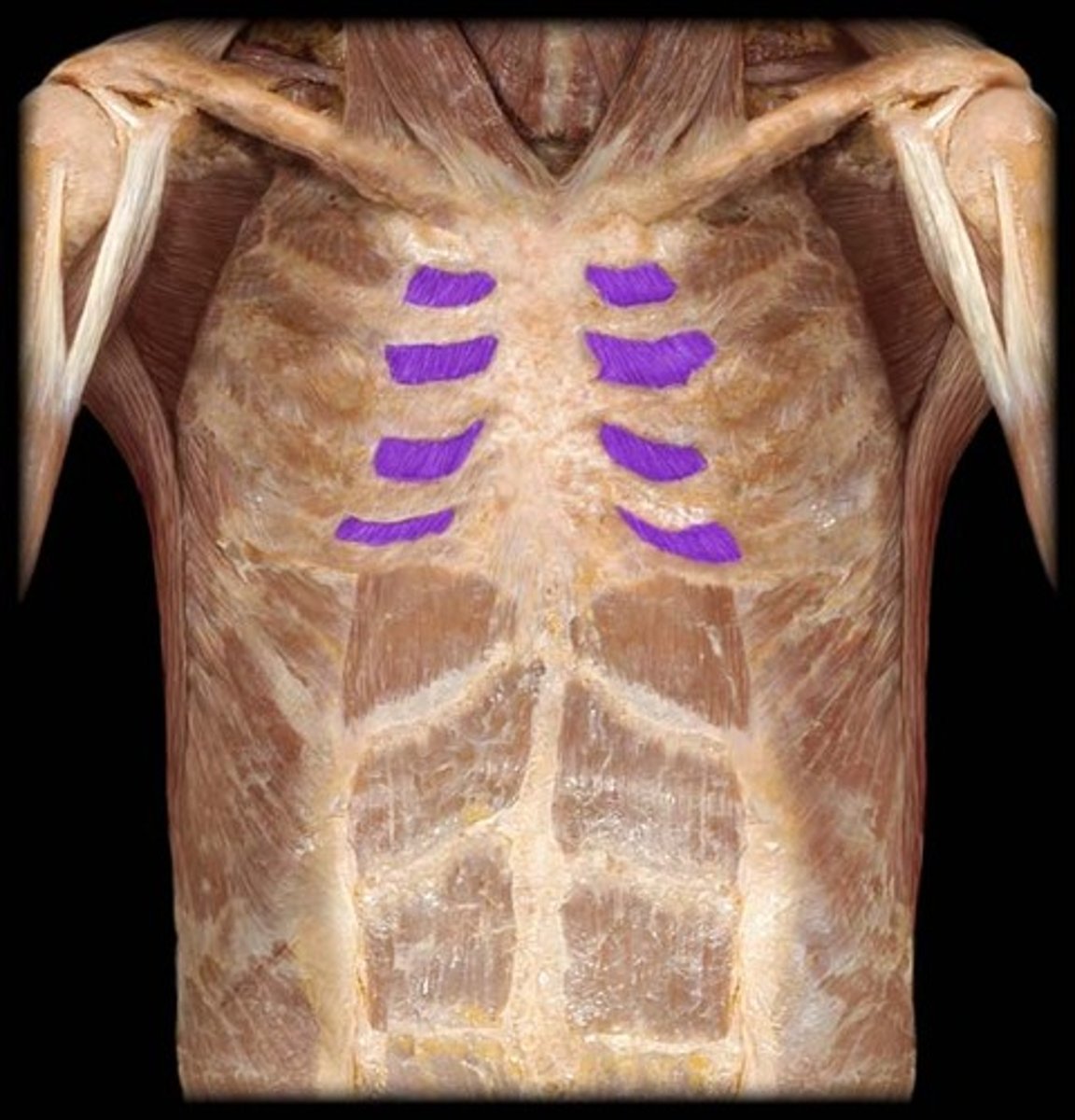 <p>depresses ribs (expiration)</p>