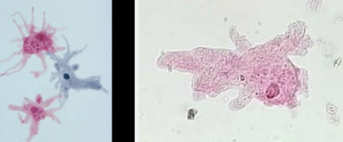 <p>What is the name of this protist?</p>