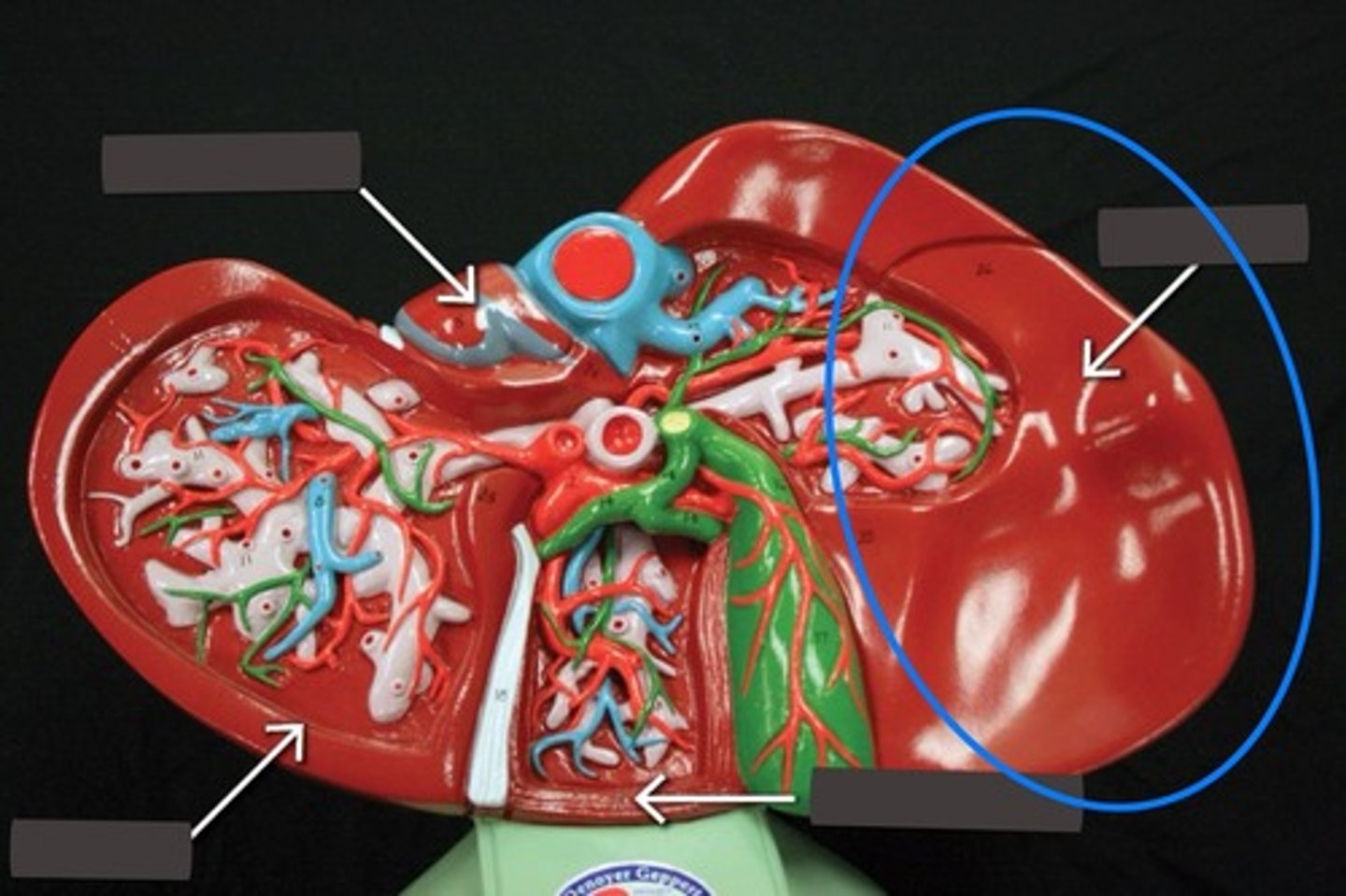 <p>Visually has less blood vessels</p>