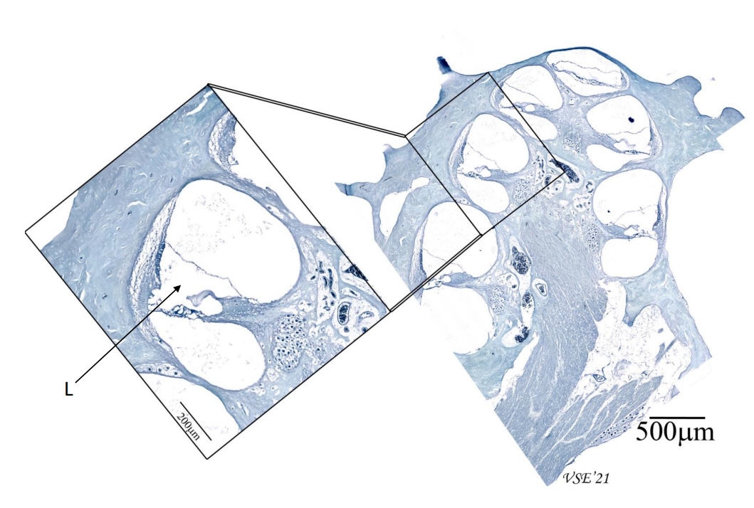 <p>Ductus cochlearis</p>