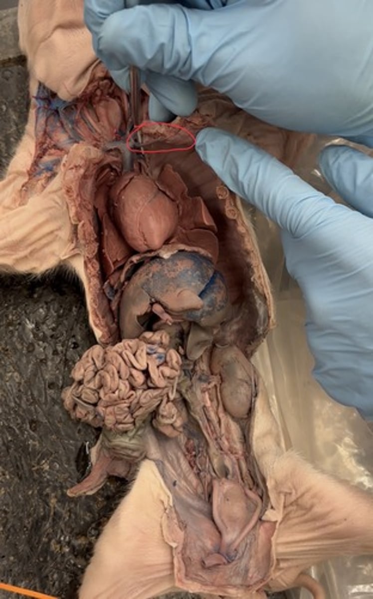 <p>anterior chest wall</p>