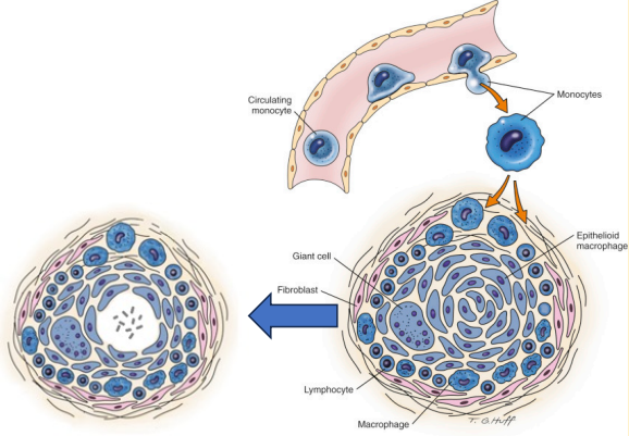 <p>What is the structure of a granuloma?</p>