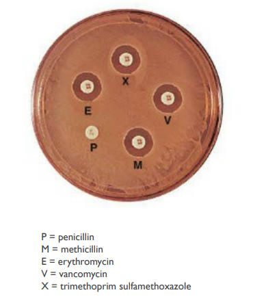 <p>(LC) You perform an antibiotic resistance test and observe these results. Which drug(s) should NOT be used to treat this patient’s infection?</p><ol><li><p>Penicillin</p></li><li><p>Methicillin</p></li><li><p>Erythromycin</p></li><li><p>Vancomycin</p></li><li><p>Trimethoprim & sulfamethoxazole</p></li><li><p>All of these drugs could be used treat this infection.</p></li></ol><p></p>