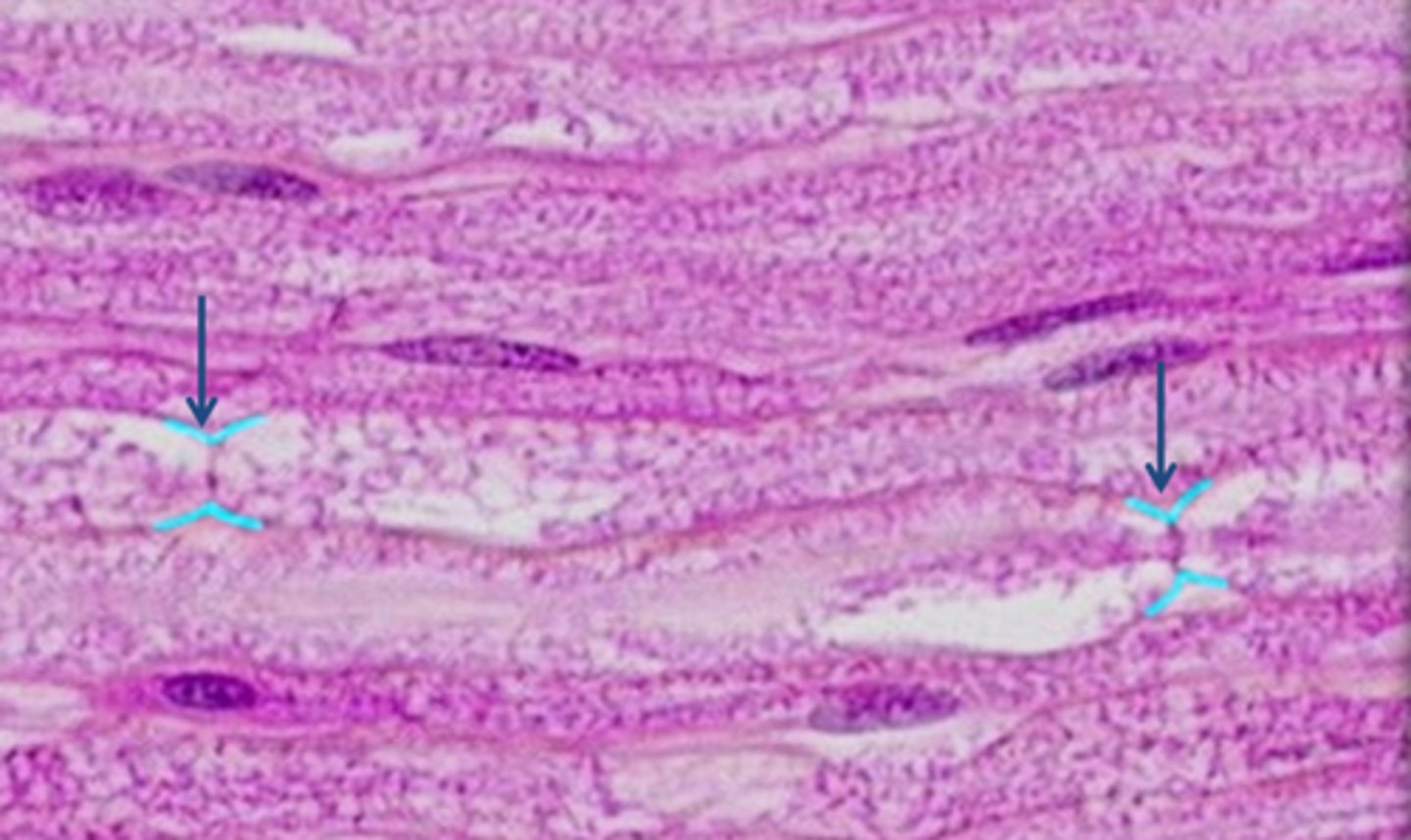 <p>Label (blue arrows).</p><p>Gaps in the myelin sheath of the axons of peripheral neruons. Action potentials can 'jump' from node to node, thus increasing the speed of conduction (saltatory conduction).</p>