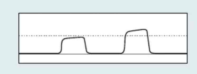 <p>which Capnography waveform is this</p>