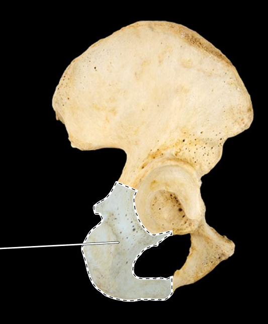 <p>Name this bone.</p><p>(Lateral view, right).</p>