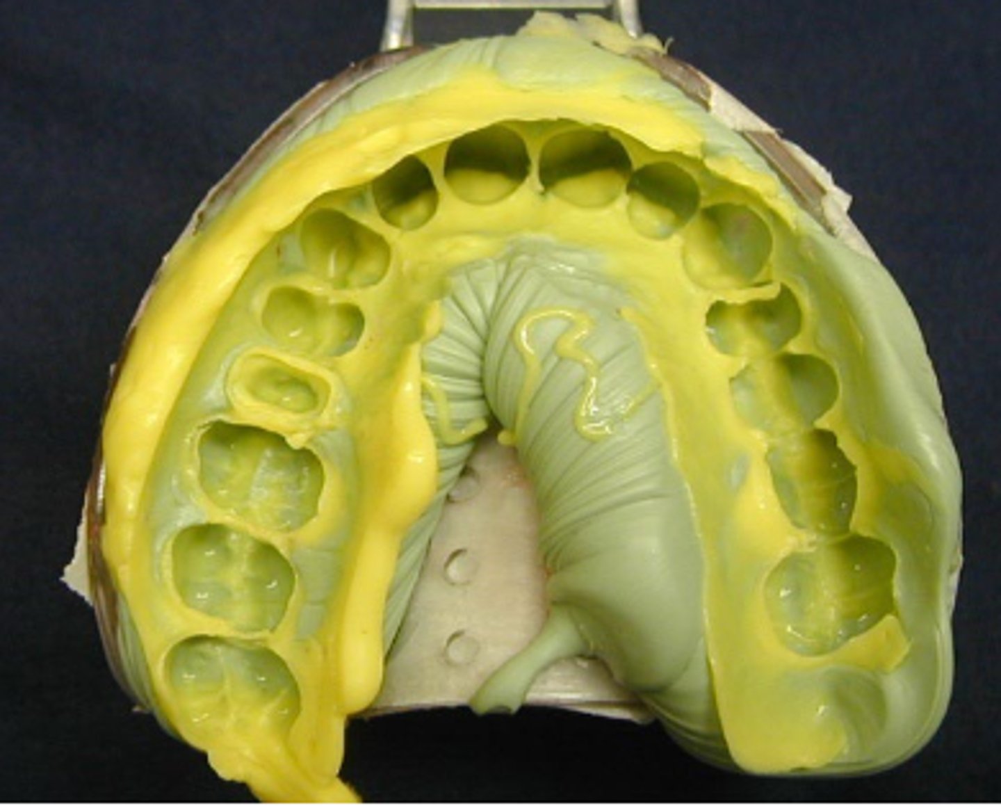 <p>What type of impression material?</p>