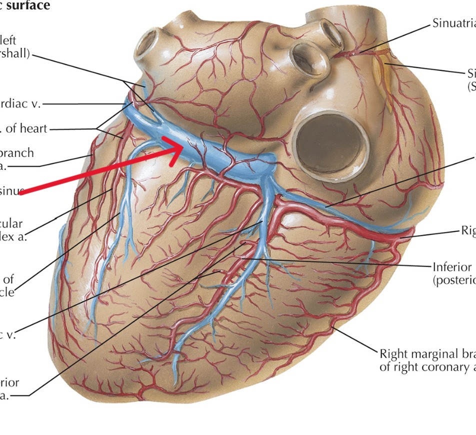 <p>Which heart circulation:</p><ul><li><p>All coronary veins dump into sinus, lies in AV sulcus</p></li></ul><p></p>