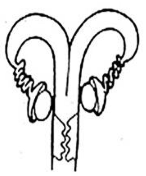 <p>Which uterine classification is this?</p>