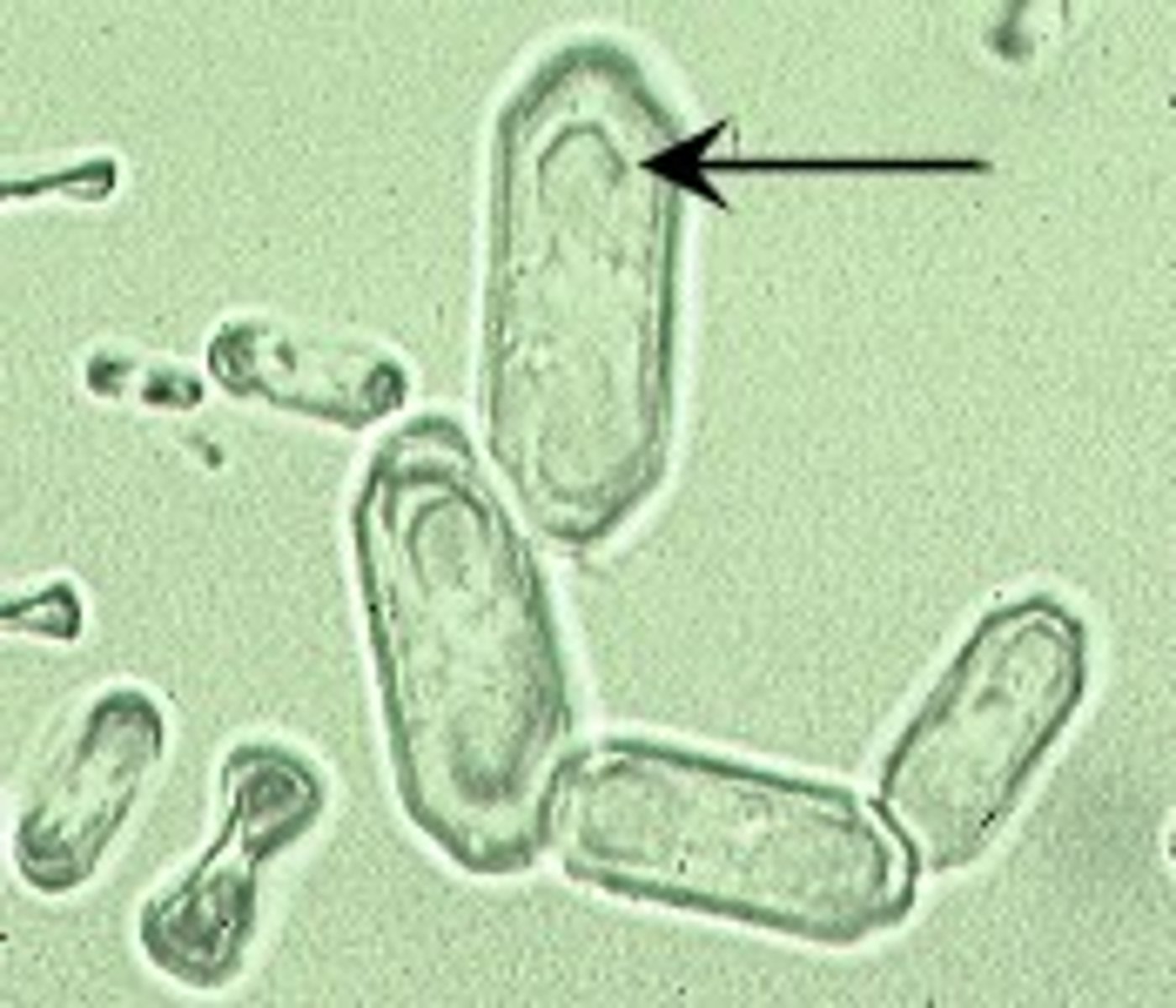 <p>acidic urine, ovoid calcium oxalate</p>