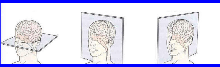 <p>From left to right, identify the specific planes:</p>